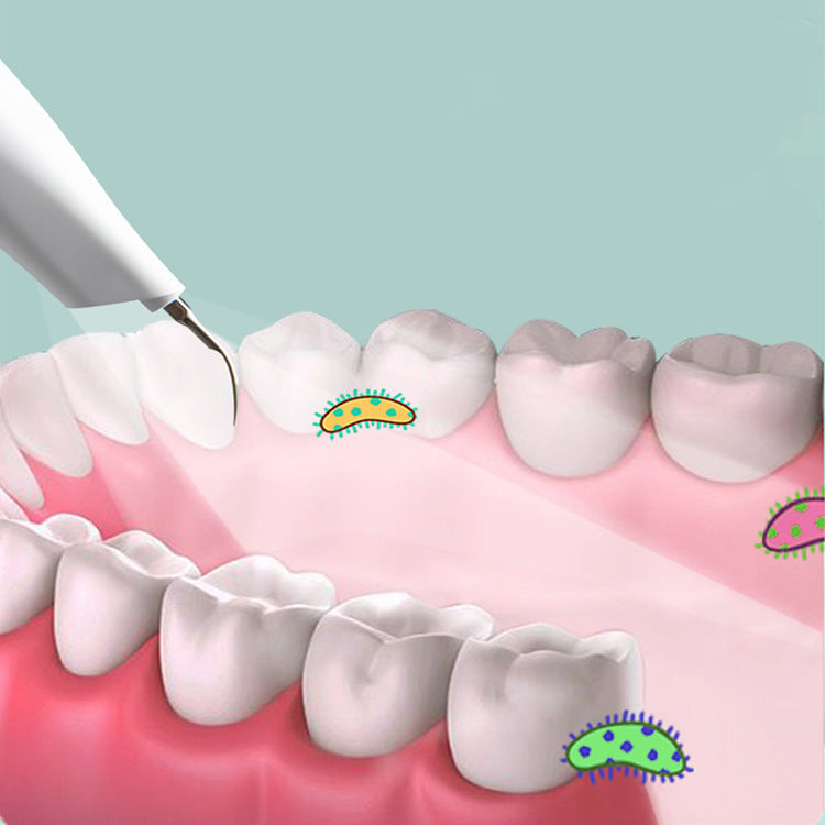 Nettoyeur dentaire à ultrasons appareil de nettoyage de soins bucco-dentaires portable élimination des calculs et blanchiment nettoyeur dentaire