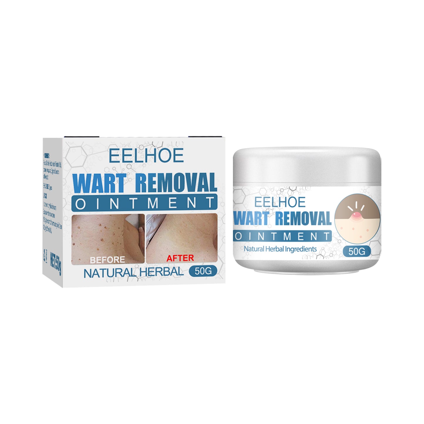 Wart Cream, Skin Clean And Smooth Wart Nevi Facial Care Cream by eprolo