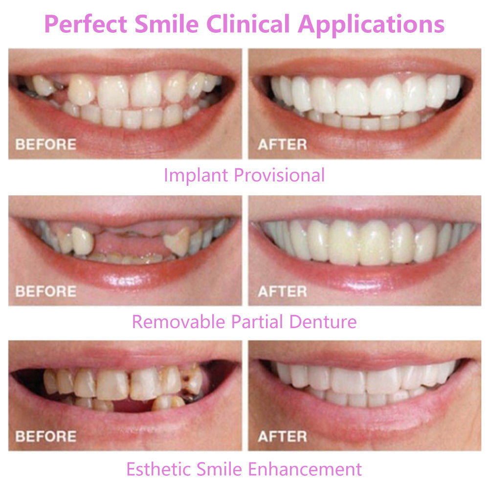 Appareils orthodontiques de simulation pour dents supérieures et inférieures Appareils orthodontiques non poreux Manchons de blanchiment Prothèses dentaires de simulation en silicone de deuxième génération 