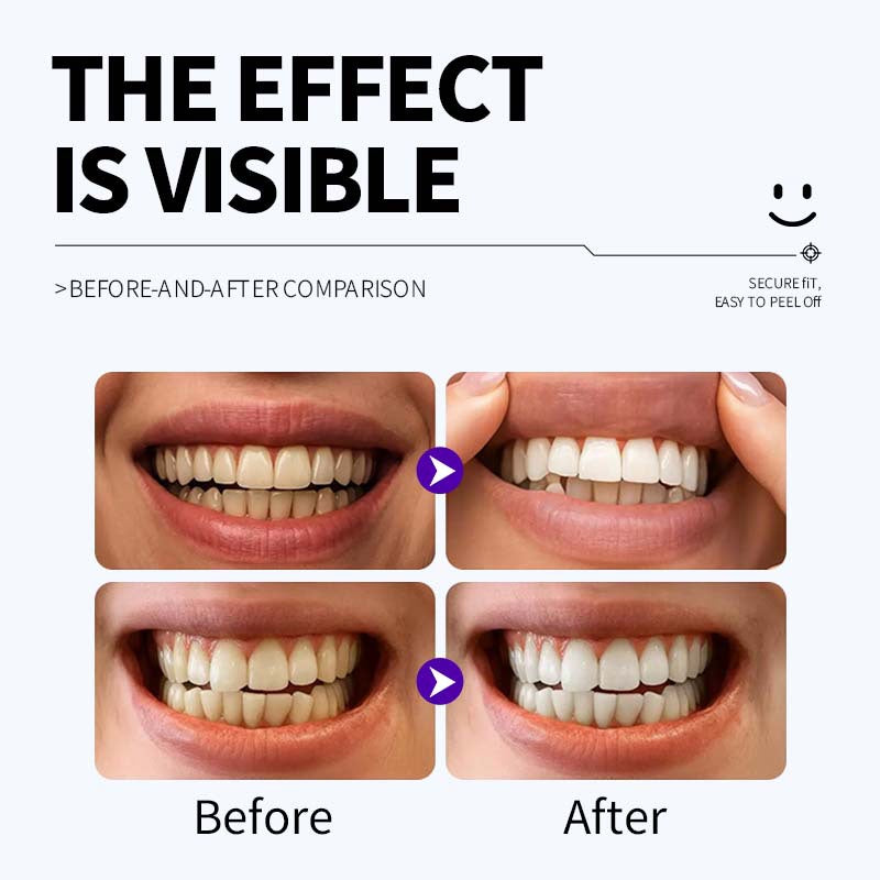 Cross-border TK popular Whitening Tooth Strips Cleansing and caring for tooth enamel layer dental strips