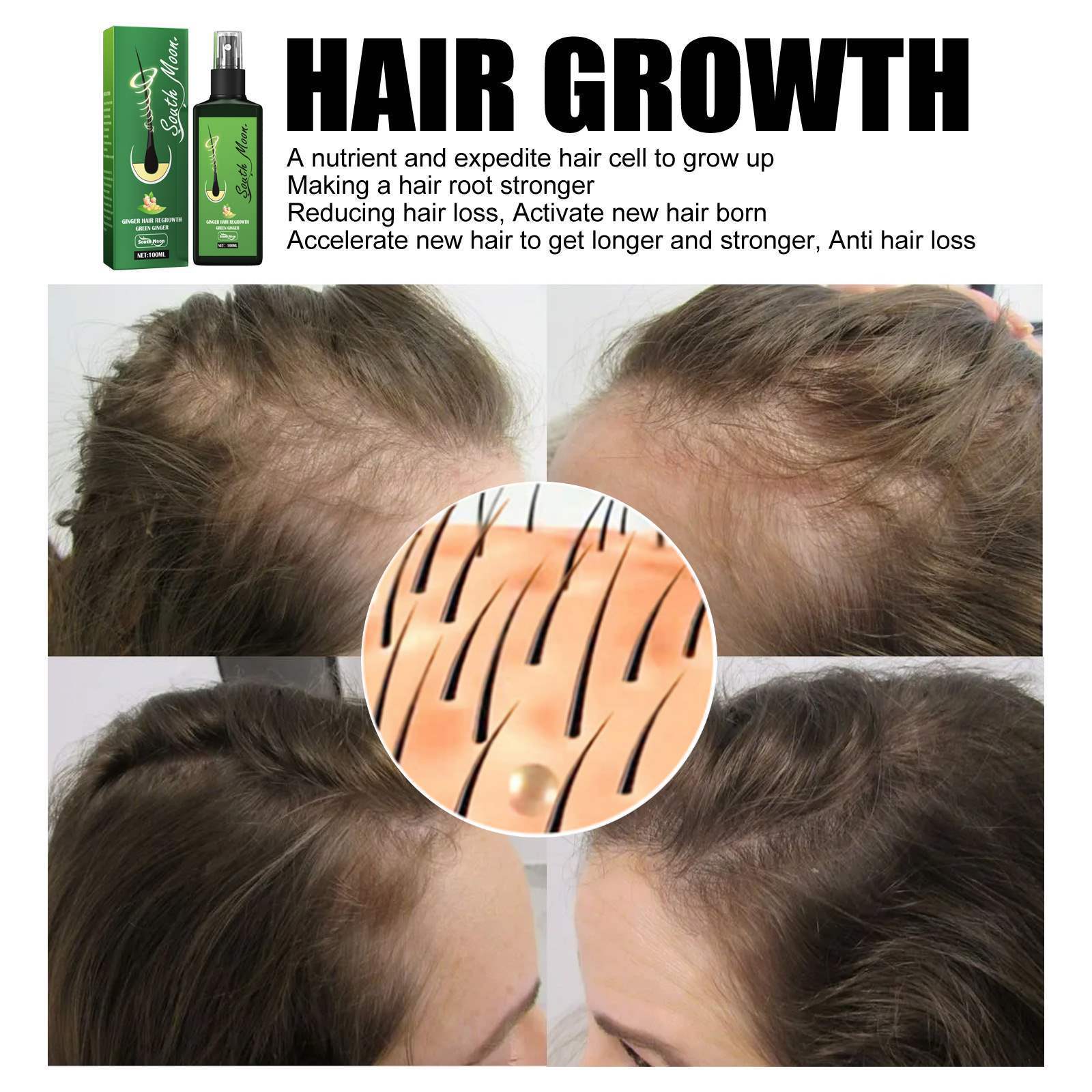 South Moon Hair Care Spray Hair Nourishing Massage Repair Hair Care Scalp Treatment Solution